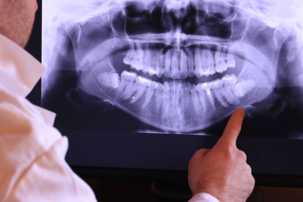 Best Emergency Tooth Extraction in Waterloo, WI